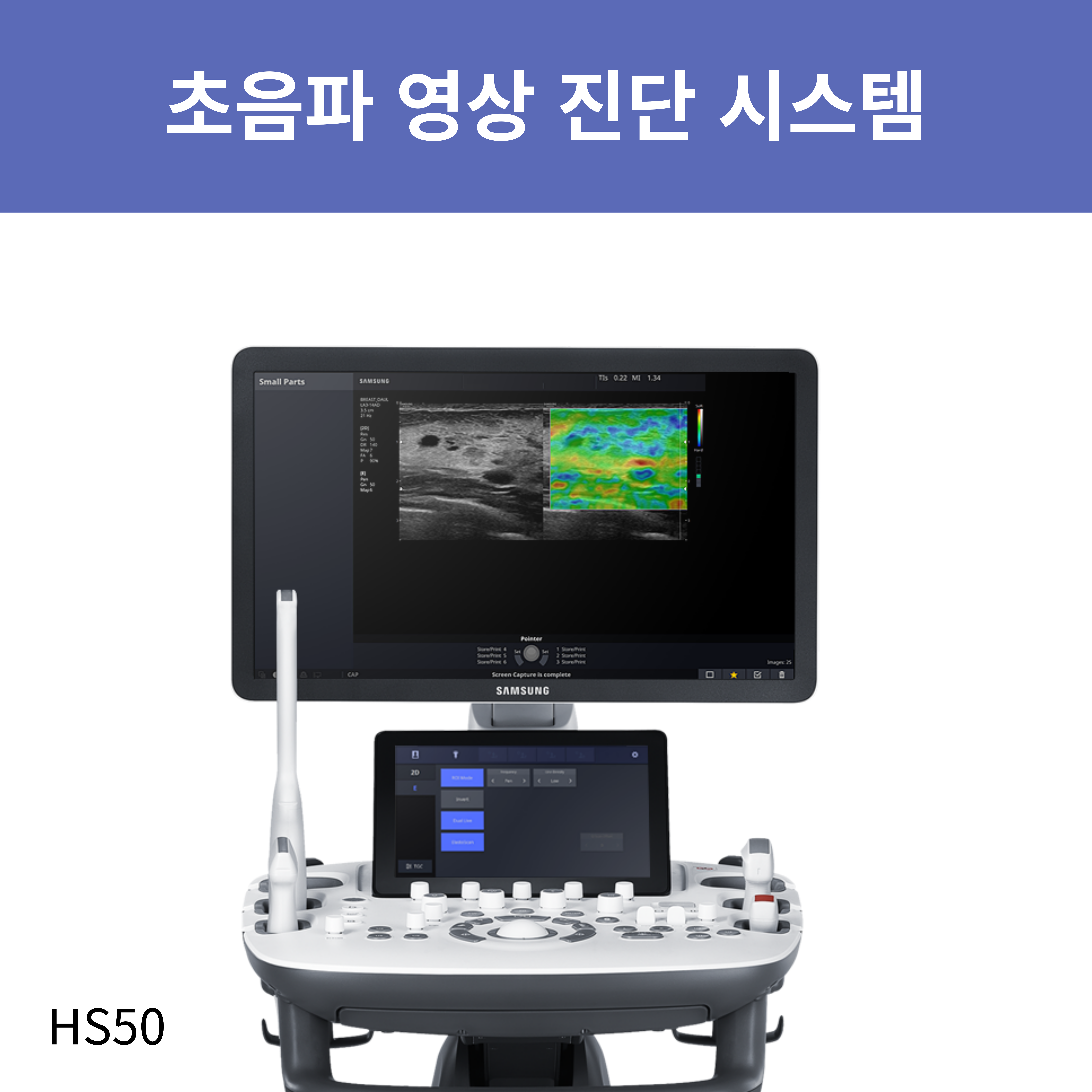 초음파시스템